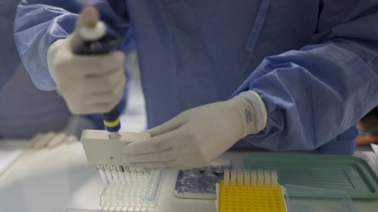 Primer caso autóctono de zika habría sido por contagio vía sexual
